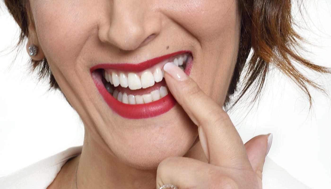 Impianti dentali singoli Studio Kol Roma