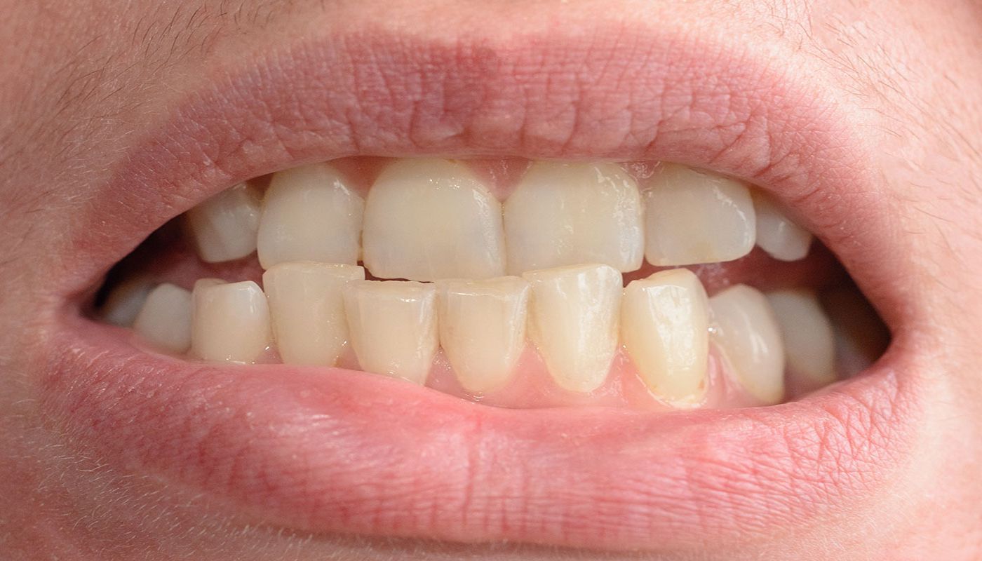 Denti che si muovono Studio Kol Roma