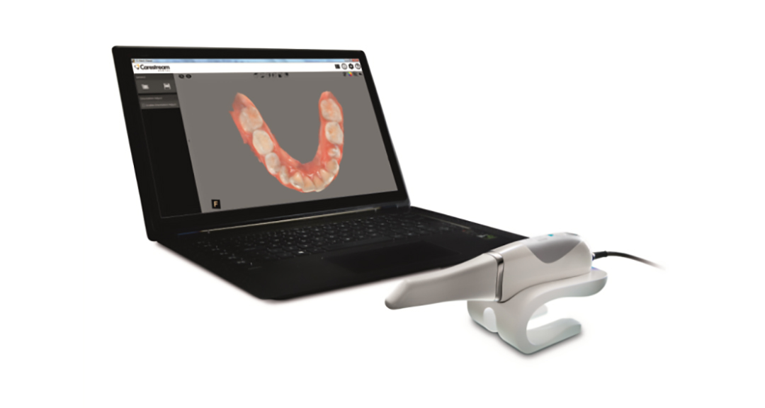 Scanner intraorale